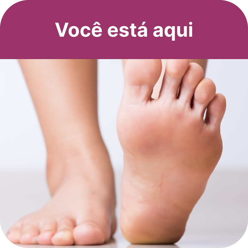 Fungos e Micoses